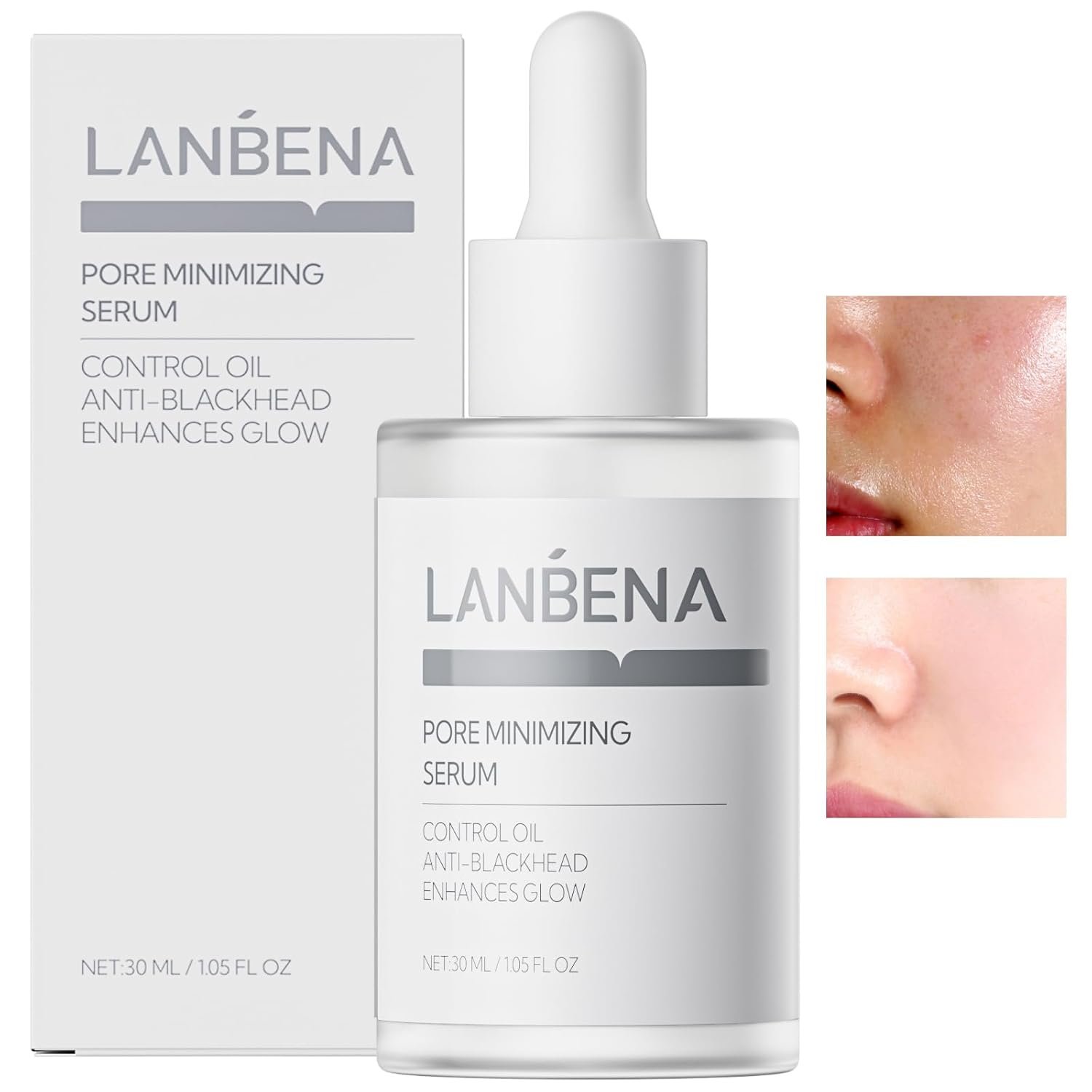 LANBENA Pore Minimizing Serum, Pore Minimizer & Reducer for Face, Shrinking, Oil Control Firming, Tightening Pores, Pore Moisture after Blackhead Remover, 30ml
